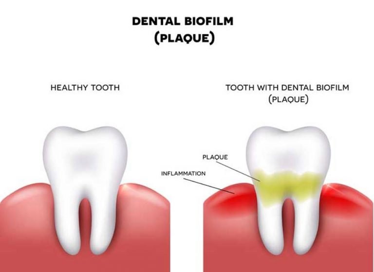 Periodontal1-768x560